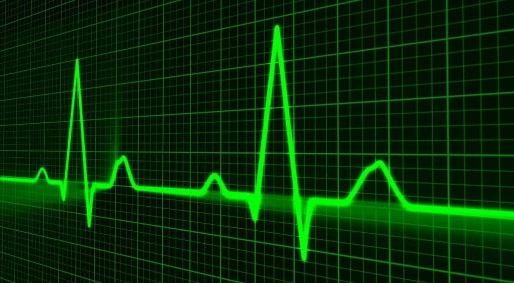 EKG