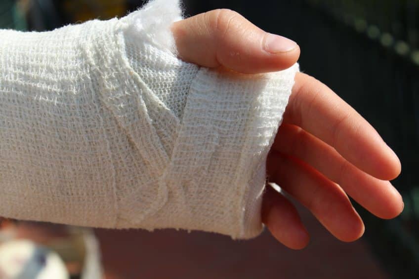 Personal Injury