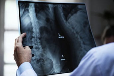 Personal Injury Back Problems Lakeland FL