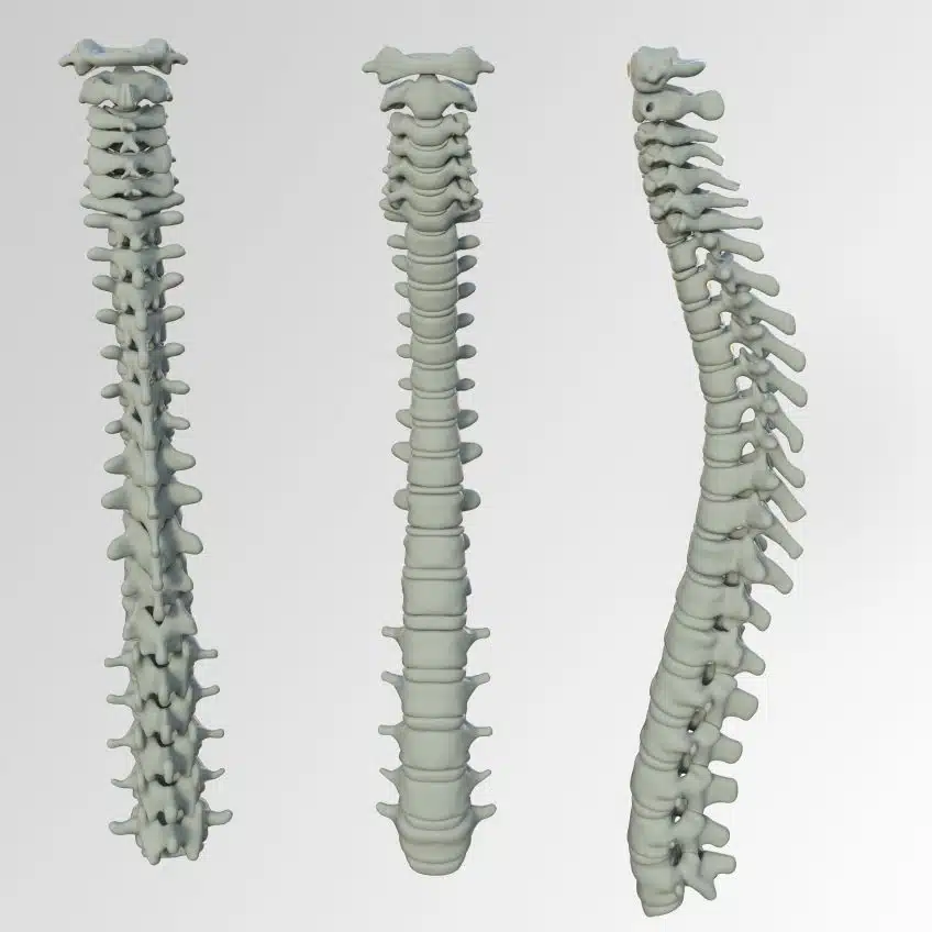 Spinal Cord Injury Lawyer Lakeland FL